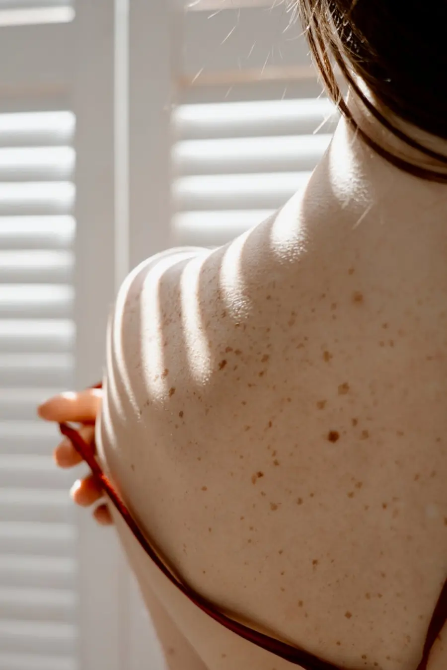 Melanoma avanzato, UniTS guida EXOMEL per cure più mirate con biopsia liquida